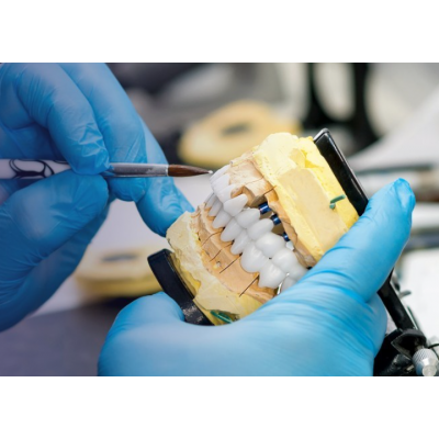 Implant zirconia bridge from MYY Dental Lab