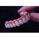 China Dental Lab Implant Crowns
